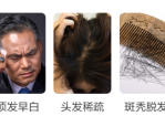 为什么会掉头发 这四大原因你注意了吗